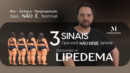 Lipedema 3 sintomas
