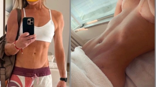 Lipo HD Dr MARco Longo