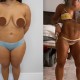 Lipo HD coxas